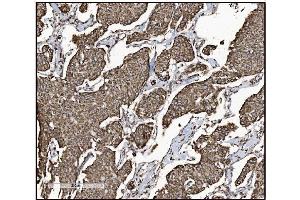IHC analysis of FABP-1/GOT2 using anti-FABP-1/GOT2 antibody (ABIN7601426). (GOT2 Antikörper  (AA 35-430))