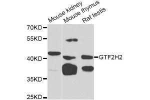 Western blot analysis of extracts of various cell lines, using GTF2H2 Antibody (ABIN1876505) at 1:1000 dilution.