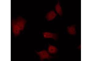 Immunofluorescence (fixed cells) (IF/ICC) image for anti-PTK2 Protein tyrosine Kinase 2 (PTK2) (pSer843) antibody (ABIN6256435)