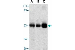 Western blot analysis of TRIM5 expression in human stomach (A), thymus (B), and uterus (C) cell lysate with TRIM5 alpha polyclonal antibody  at 2 ug /mL . (TRIM5 Antikörper  (C-Term))
