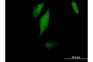 Immunofluorescence of purified MaxPab antibody to CC2D1A on HeLa cell.
