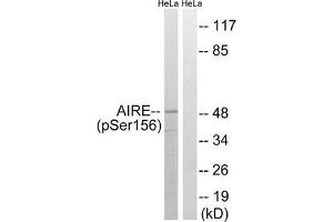 Western blot analysis of extracts from HeLa cells treated with Hu using AIRE (Phospho-Ser156) Antibody. (AIRE Antikörper  (pSer156))