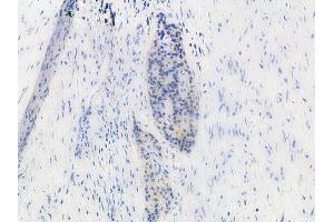 anti-Mitogen-Activated Protein Kinase Kinase 1/2 (MAP2K1/2) (pSer221), (pSer222) antibody