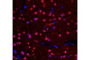 Immunofluorescence of paraffin embedded rat corpus striatum using NCBP2 (ABIN7074870) at dilution of 1: 650 (400x lens) (NCBP2 Antikörper)