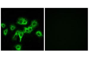 Immunofluorescence analysis of MCF-7 cells, using CDON antibody. (CDON Antikörper  (Internal Region))