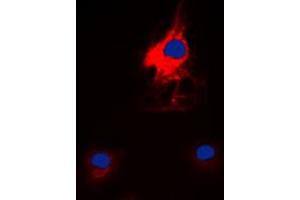 Immunofluorescent analysis of HARS staining in K562 cells. (HARS1/Jo-1 Antikörper  (C-Term))
