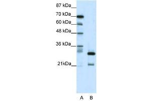 HMOX2 antibody (70R-10556) used at 0. (HMOX2 Antikörper  (N-Term))