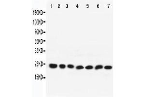 Western Blotting (WB) image for anti-RAB9A, Member RAS Oncogene Family (RAB9A) (AA 178-193), (C-Term) antibody (ABIN3042553) (RAB9A Antikörper  (C-Term))