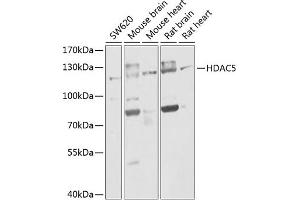 Western blot analysis of extracts of various cell lines, using HD antibody (ABIN6133742, ABIN6141675, ABIN6141678 and ABIN6213911) at 1:1000 dilution. (HDAC5 Antikörper  (AA 550-650))