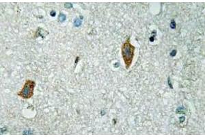 Immunohistochemistry (IHC) analyzes of PAI-2 antibody in paraffin-embedded human brain tissue. (SERPINB2 Antikörper)