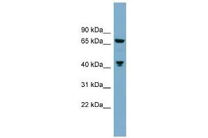 GLS antibody used at 1 ug/ml to detect target protein. (Glutaminase Antikörper  (Middle Region))