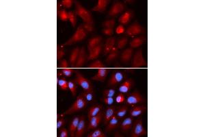Immunofluorescence (IF) image for anti-Proteasome (Prosome, Macropain) Subunit, beta Type 2 (PSMB2) antibody (ABIN1876671) (PSMB2 Antikörper)