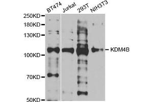 Western blot analysis of extracts of various cell lines, using KDM4B antibody (ABIN5973438) at 1/1000 dilution. (KDM4B Antikörper)