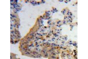 Used in DAB staining on fromalin fixed paraffin-embedded Lung tissue (IL-7 Antikörper  (AA 26-154))