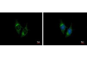 ICC/IF Image BNP antibody [N1C3] detects BNP protein at cytoplasm by immunofluorescent analysis. (NPPB Antikörper)