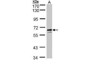 WB Image Sample (30 ug of whole cell lysate) A: HeLa S3 , 7. (Glucose-6-Phosphate Dehydrogenase Antikörper)