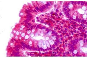 Immunohistochemistry (IHC) image for anti-Cadherin EGF LAG Seven Pass G-Type Receptor 2 (CELSR2) (C-Term) antibody (ABIN1048432)