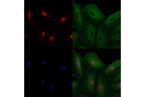 ABIN6260604 and ABIN6272502 staining  cells by IF/ICC.
