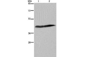 Western Blot analysis of Human placenta tissue and HepG2 cell using CD116 Polyclonal Antibody at dilution of 1:250 (CSF2RA Antikörper)