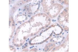 Detection of CLEC4C in Human Kidney Tissue using Polyclonal Antibody to C-Type Lectin Domain Family 4, Member C (CLEC4C)