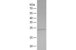 Western Blotting (WB) image for Suppressor of IKBKE 1 (SIKE1) (AA 1-207) protein (His tag) (ABIN7125257)