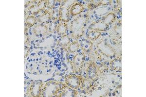 Immunohistochemistry of paraffin-embedded rat kidney using EPO antibody. (EPO Antikörper)
