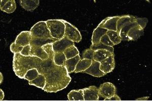 Immunofluorescent staining on WIDR cells at 1:50 dilution of E-Cadherin. (E-cadherin Antikörper  (C-Term))