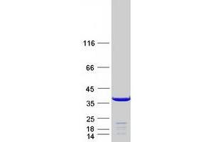 Validation with Western Blot (MAPRE3 Protein (Myc-DYKDDDDK Tag))