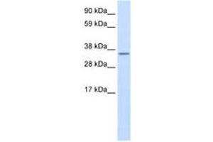 Image no. 1 for anti-Unconventional SNARE in The ER 1 Homolog (Use1) (N-Term) antibody (ABIN6736070) (Use1 Antikörper  (N-Term))