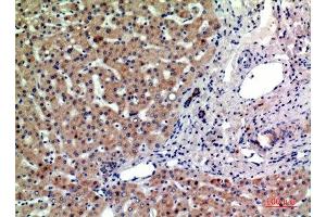 Immunohistochemistry (IHC) image for anti-Prostaglandin F2 Receptor Negative Regulator (PTGFRN) (Internal Region) antibody (ABIN7186219)