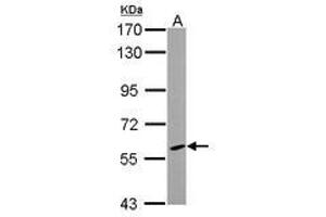 Image no. 1 for anti-Cytochrome P450, Family 46, Subfamily A, Polypeptide 1 (CYP46A1) (AA 15-315) antibody (ABIN1497738) (CYP46A1 Antikörper  (AA 15-315))