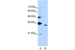 WB Suggested Anti-PPIE  Antibody Titration: 1. (PPIE Antikörper  (Middle Region))