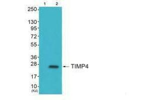Western blot analysis of extracts from HepG2 cells (Lane 2), using TIMP4 antiobdy. (TIMP4 Antikörper  (C-Term))