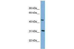 WB Suggested Anti-SERPINI2  Antibody Titration: 0. (SERPINI2 Antikörper  (Middle Region))