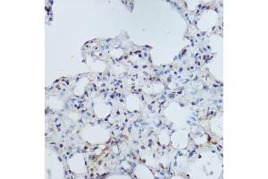 Immunohistochemistry of paraffin-embedded mouse lung using DDB1 Rabbit pAb (ABIN1679509, ABIN5664466, ABIN5664468 and ABIN6220382) at dilution of 1:350 (40x lens). (DDB1 Antikörper  (C-Term))