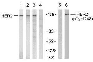 Western blot analysis using HER2 (Ab-1248) antibody (E021072, Line 1, 2, 3 and 4) and HER2 (phospho-Tyr1248) antibody (E011079, Line 5 and 6). (ErbB2/Her2 Antikörper  (pTyr1248))