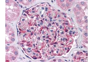 Human Kidney: Formalin-Fixed, Paraffin-Embedded (FFPE) (FRMPD4 Antikörper)