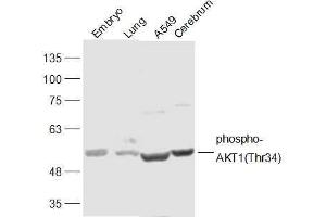 Lane 1: Mouse Embryo lysates Lane 2: Mouse Lung lysates Lane 3: A549 lysates Lane 4: Mouse Cerebrum lysates probed with AKT1(Thr34) Polyclonal Antibody, Unconjugated  at 1:300 dilution and 4˚C overnight incubation.