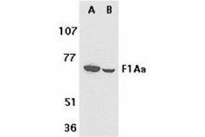 Western blot analysis of F1A alpha in mouse (A) and rat (B) liver tissue lysates with AP30325PU-N F1A alpha antibody at 1 μg/ml. (FEM1B Antikörper  (C-Term))