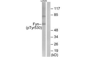 Western Blotting (WB) image for anti-FYN Oncogene Related To SRC, FGR, YES (FYN) (pTyr530) antibody (ABIN1847258) (FYN Antikörper  (pTyr530))