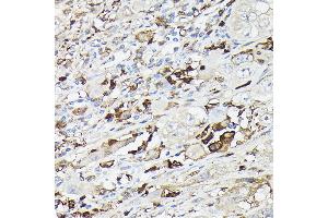 Immunohistochemistry (IHC) image for anti-Gelsolin (GSN) (AA 543-782) antibody (ABIN7267365)