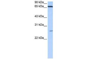 DKFZp686E2433 antibody used at 0. (ZNF879 Antikörper  (N-Term))