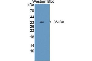 Western blot analysis of the recombinant protein. (SHP1 Antikörper  (AA 244-515))