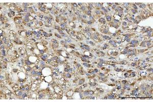 IHC analysis of MSF/SEPTIN9 using anti-MSF/SEPTIN9 antibody (ABIN7600104). (Septin 9 Antikörper  (AA 15-282))