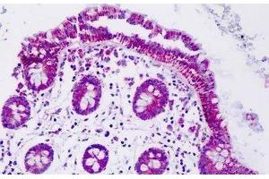Human Colon: Formalin-Fixed, Paraffin-Embedded (FFPE)