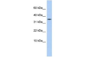 WB Suggested Anti-DYSFIP1 Antibody Titration: 0. (PPP1R27 Antikörper  (Middle Region))