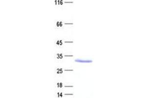 Validation with Western Blot (UPK3BL Protein (His tag))