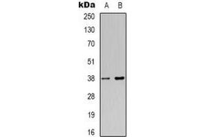 Western blot analysis of NDRG4 expression in Jurkat (A), HepG2 (B) whole cell lysates. (NDRG4 Antikörper)