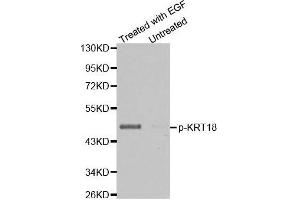 Western blot analysis of extracts from HT29 cells untreated or treated with EGF using Phospho-KRT18-S33 antibody. (Cytokeratin 18 Antikörper  (pSer33))