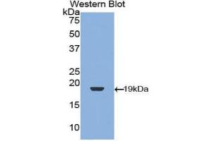 Western Blotting (WB) image for anti-Transforming Growth Factor, beta 1 (TGFB1) (AA 279-390) antibody (ABIN3209254) (TGFB1 Antikörper  (AA 279-390))